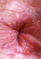 Aubry Babcock Yoga Spreading, Aubry Babcock (aub014) ATK Exotics: Aubry Babcock (Aubry Babcock Yoga Spreading)