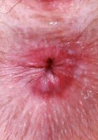 Big Eyes from ATK Petites