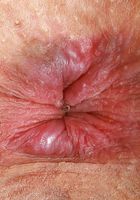 Felicia Fisher Hairy Spreads Outdoors, Felicia Fisher (fel024) ATK Natural & Hairy: Felicia Fisher (Felicia Fisher Hairy Spreads Outdoors)