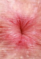 Fiona Peaches shows it off, Fiona Peaches (fio012) ATK Natural & Hairy: Fiona Peaches (Fiona Peaches shows it off)