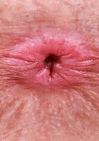 ATK Petites: Juniper Ren (Juniper Ren Green Dress Stripping and Pussy Spreading)