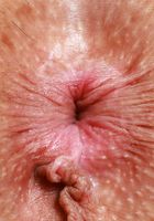 Ophelia Fae Short Skirt Strip and Spreading, Ophelia Fae (oph002) ATK Galleria: Ophelia Fae (Ophelia Fae Short Skirt Strip and Spreading)