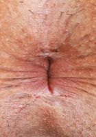 Penelope Reed Hole Spreads, Penelope Reed (pen027) ATK Exotics: Penelope Reed (Penelope Reed Hole Spreads)