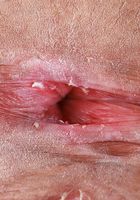 Salee Lee Wide Exotic Pussy Spreads, Salee Lee (sal024) ATK Exotics: Salee Lee (Salee Lee Wide Exotic Pussy Spreads)